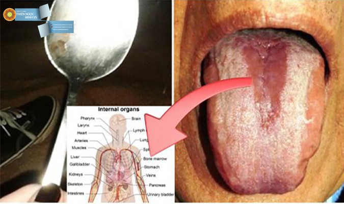 60 giây với 1 chiếc thìa, bạn sẽ biết được nội tạng của mình có bị nhiễm độc hay không?
